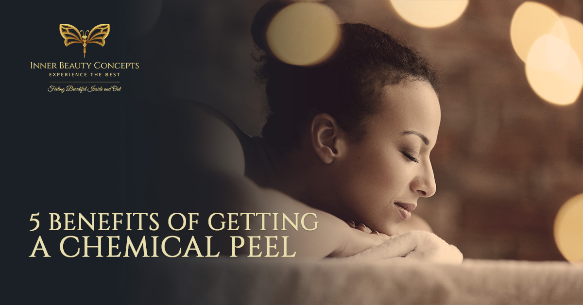 5-Benefits-Of-Getting-A-Chemical-Peel-5bfd591280911