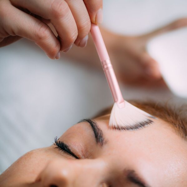 chemical peel