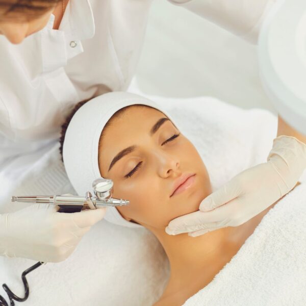 chemical peel services