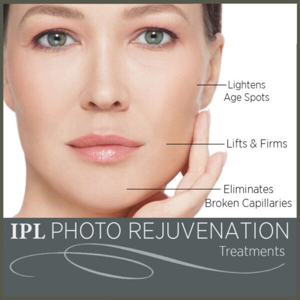 IPL Photo Rejuvenation benefits