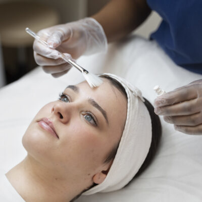 woman getting chemical peel