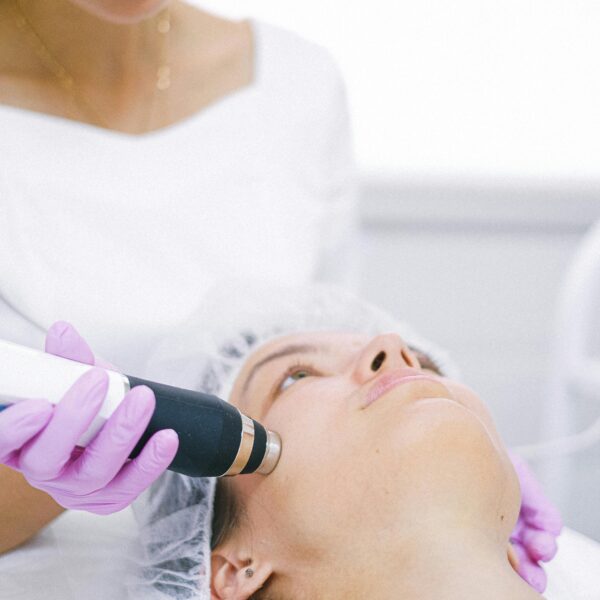 microdermabraison