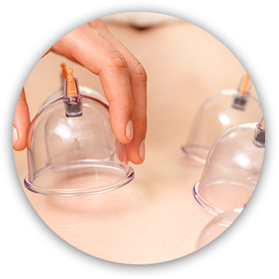 cupping therapy